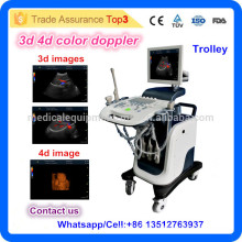 MSLCU24I Gynecoloy тележка цифровая доплеровская ультразвуковая машина / 4d ультразвуковая машина